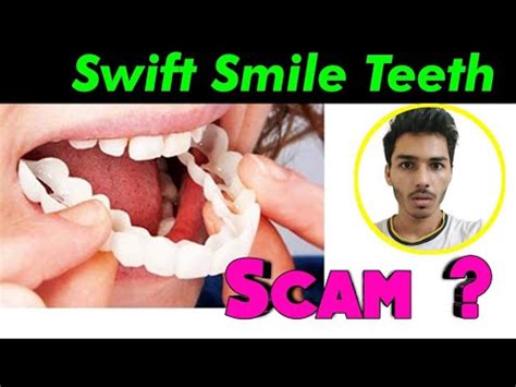 swift smile teeth brace
